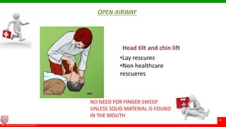 © Ramaiah University of Applied Sciences
11
Faculty of Pharmacy©M. S. Ramaiah University of Applied Sciences
11
OPEN AIRWAY
Head tilt and chin lift
•Lay rescures
•Non healthcare
rescueres
NO NEED FOR FINGER SWEEP
UNLESS SOLID MATERIAL IS FOUND
IN THE MOUTH
 