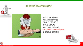 © Ramaiah University of Applied Sciences
19
Faculty of Pharmacy©M. S. Ramaiah University of Applied Sciences
19
30 CHEST COMPRESSIONS
•APPROCH SAFELY
•CHECK RESPONSE
•SHOUT FOR HELP
•OPEN AIRWAY
•CHECK BREATHING
•30 CHEST COMPRESSION
•2 RESCUE BREATHS
 