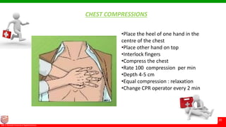 © Ramaiah University of Applied Sciences
20
Faculty of Pharmacy©M. S. Ramaiah University of Applied Sciences
20
CHEST COMPRESSIONS
•Place the heel of one hand in the
centre of the chest
•Place other hand on top
•Interlock fingers
•Compress the chest
•Rate 100 compression per min
•Depth 4-5 cm
•Equal compression : relaxation
•Change CPR operator every 2 min
 