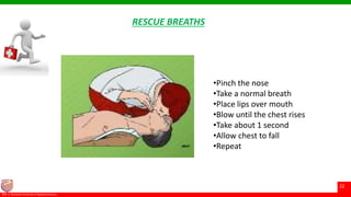 © Ramaiah University of Applied Sciences
22
Faculty of Pharmacy©M. S. Ramaiah University of Applied Sciences
22
RESCUE BREATHS
•Pinch the nose
•Take a normal breath
•Place lips over mouth
•Blow until the chest rises
•Take about 1 second
•Allow chest to fall
•Repeat
 