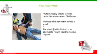 © Ramaiah University of Applied Sciences
24
Faculty of Pharmacy©M. S. Ramaiah University of Applied Sciences
24
How AEDs Work
•Automatically checks victim’s
heart rhythm to detect fibrillation
•Advises whether victim needs a
shock
•
The shock (defibrillation) is an
attempt to return heart to normal
rhythm
 