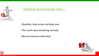 © Ramaiah University of Applied Sciences
28
Faculty of Pharmacy©M. S. Ramaiah University of Applied Sciences
28
CONTINUE RESUSCITATION UNTIL….
•Qualified help arrives and takes over
•The victim starts breathing normally
•Rescuer becomes exhausted
 