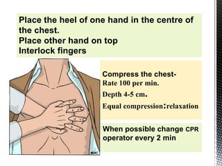 Place the heel of one hand in the centre of
the chest.
Place other hand on top
Interlock fingers
When possible change CPR
operator every 2 min
 