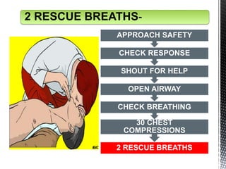 2 RESCUE BREATHS
30 CHEST
COMPRESSIONS
CHECK BREATHING
OPEN AIRWAY
SHOUT FOR HELP
CHECK RESPONSE
APPROACH SAFETY
2 RESCUE BREATHS-
 