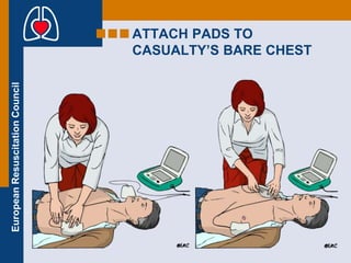 BASIC LIFE SUPPORT | PPT