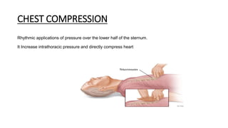 CHEST COMPRESSION
Rhythmic applications of pressure over the lower half of the sternum.
It Increase intrathoracic pressure and directly compress heart
 