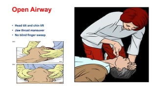 Open Airway
• Head tilt and chin lift
• Jaw thrust maneuver
• No blind finger sweep
 
