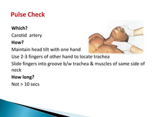 Which?
Carotid artery
How?
Maintain head tilt with one hand
Use 2-3 fingers of other hand to locate trachea
Slide fingers into groove b/w trachea & muscles of same side of
neck
How long?
Not > 10 secs
 
