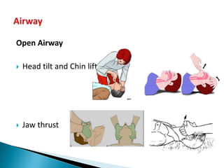 Open Airway
 Head tilt and Chin lift
 Jaw thrust
 