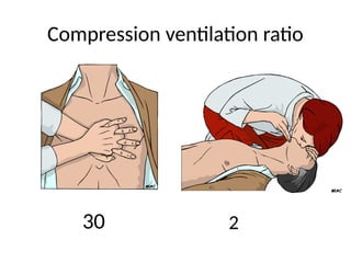Basic life support - BLS - explained.pptx