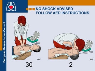 NO SHOCK ADVISED FOLLOW AED INSTRUCTIONS   30   2 