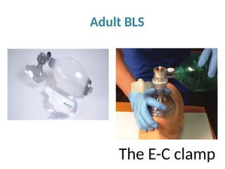 Adult BLS
The E-C clamp
 