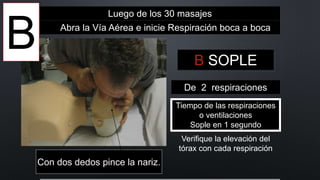 Luego de los 30 masajes
Abra la Vía Aérea e inicie Respiración boca a boca
B SOPLE
Tiempo de las respiraciones
o ventilaciones
Sople en 1 segundo
Verifique la elevación del
tórax con cada respiración
De 2 respiraciones
Con dos dedos pince la nariz.
B
 