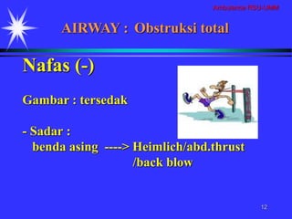 Ambulance RSU-UMM
12
Nafas (-)
Gambar : tersedak
- Sadar :
benda asing ----> Heimlich/abd.thrust
/back blow
AIRWAY : Obstruksi total
 