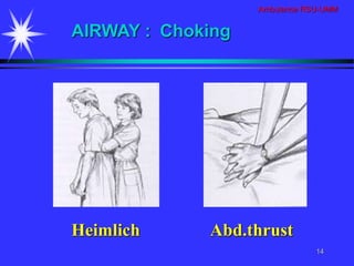 Ambulance RSU-UMM
14
Heimlich Abd.thrust
AIRWAY : Choking
 