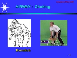 Ambulance RSU-UMM
15
Heimlich
AIRWAY : Choking
 