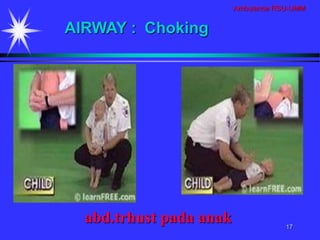 Ambulance RSU-UMM
17
abd.trhust pada anak
AIRWAY : Choking
 