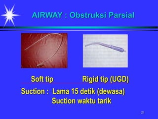 21
Soft tip Rigid tip (UGD)
AIRWAY : Obstruksi Parsial
Suction : Lama 15 detik (dewasa)
Suction waktu tarik
 