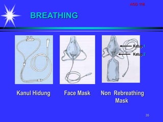 AGD 118
35
BREATHING
Face Mask Non Rebreathing
Mask
Kanul Hidung
Katup 1
Katup 2
 