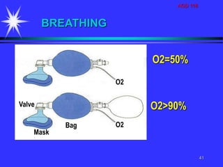 AGD 118
41
O2=50%
O2>90%
BREATHING
Bag
Valve
Mask
O2
O2
 