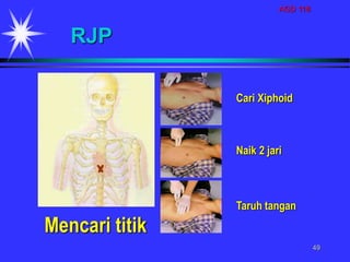 AGD 118
49
Mencari titik
RJP
Cari Xiphoid
Naik 2 jari
Taruh tangan
 