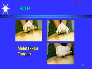 AGD 118
50
RJP
Meletakkan
Tangan
 