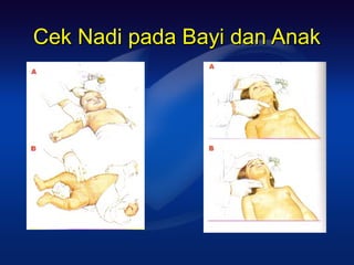 Cek Nadi pada Bayi dan Anak
 