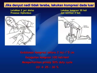Jika denyut nadi tidak teraba, lakukan kompresi dada luar
   Letakkan 2 jari diatas                    Lakukan kompresi 30 kali
   Prosesus Xiphoideus                       dan ventilasi 2 kali




            Kedalaman kompresi antara 2 inci / 5 cm
                Kecepatan kompresi 100 kali/mnt
             Memperhatikan prinsip 50% duty cycle
                            CO  25 – 30 %
 