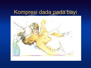 Kompresi dada pada bayi
 