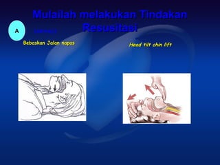 Mulailah melakukan Tindakan
A      (airway) Resusitasi
    Bebaskan Jalan napas   Head tilt chin lift
 