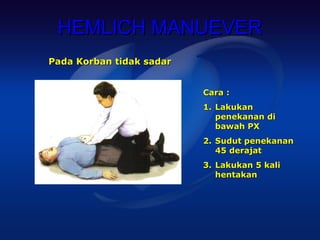 HEMLICH MANUEVER
Pada Korban tidak sadar


                          Cara :
                          1. Lakukan
                             penekanan di
                             bawah PX
                          2. Sudut penekanan
                             45 derajat
                          3. Lakukan 5 kali
                             hentakan
 