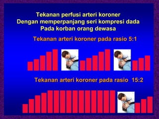 Tekanan perfusi arteri koroner
Dengan memperpanjang seri kompresi dada
       Pada korban orang dewasa
     Tekanan arteri koroner pada rasio 5:1




     Tekanan arteri koroner pada rasio 15:2
 