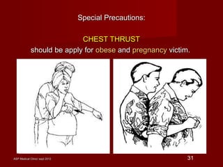 ASP Medical Clinic/ sept 2012ASP Medical Clinic/ sept 2012 31
Special Precautions:Special Precautions:
CHEST THRUSTCHEST THRUST
should be apply forshould be apply for obeseobese andand pregnancypregnancy victim.victim.
 