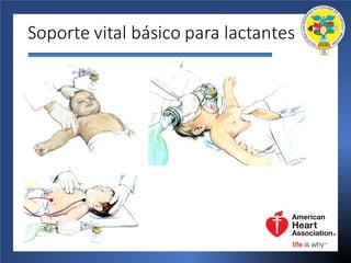Soporte	vital	básico	para	lactantes
 