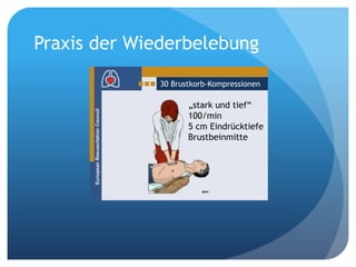 30 Brustkorb-Kompressionen
„stark und tief“
100/min
5 cm Eindrücktiefe
Brustbeinmitte
Praxis der Wiederbelebung
 