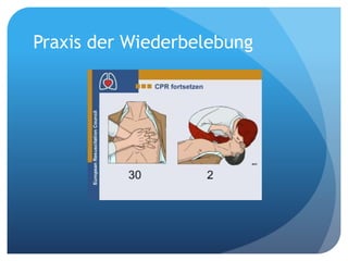 Praxis der Wiederbelebung
 