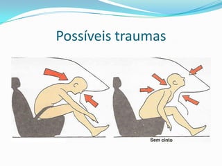 Possíveis traumas
 