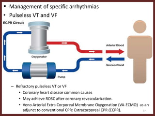  Management of specific arrhythmias
• Pulseless VT and VF
– Non -perfusing rhythms emanating from the ventricles
– Requires excellent cardiopulmonary resuscitation (CPR) and rapid
defibrillation.
– Treatable underlying causes should be identified and managed as quickly as
possible
– Decreased time to defibrillation improves the likelihood of successful
conversion to a perfusing rhythm and patient survival.
– VT/VF that persists after defibrillation may be treated with amiodarone or
lidocaine.
– Refractory pulseless VT or VF
• Coronary heart disease common causes
• May achieve ROSC after coronary revascularization.
• Veno Arterial Extra Corporeal Membrane Oxygenation (VA-ECMO) as an
adjunct to conventional CPR: Extracorporeal CPR (ECPR). 37
 