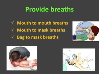 Provide breaths
 Mouth to mouth breaths
 Mouth to mask breaths
 Bag to mask breaths
 