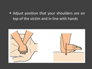  Adjust position that your shoulders are on
top of the victim and in line with hands
 