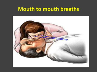 Mouth to mouth breaths
 