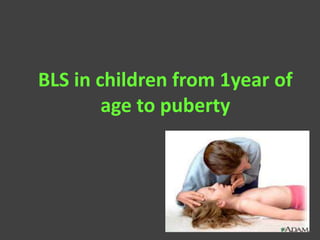 BLS in children from 1year of
age to puberty
 