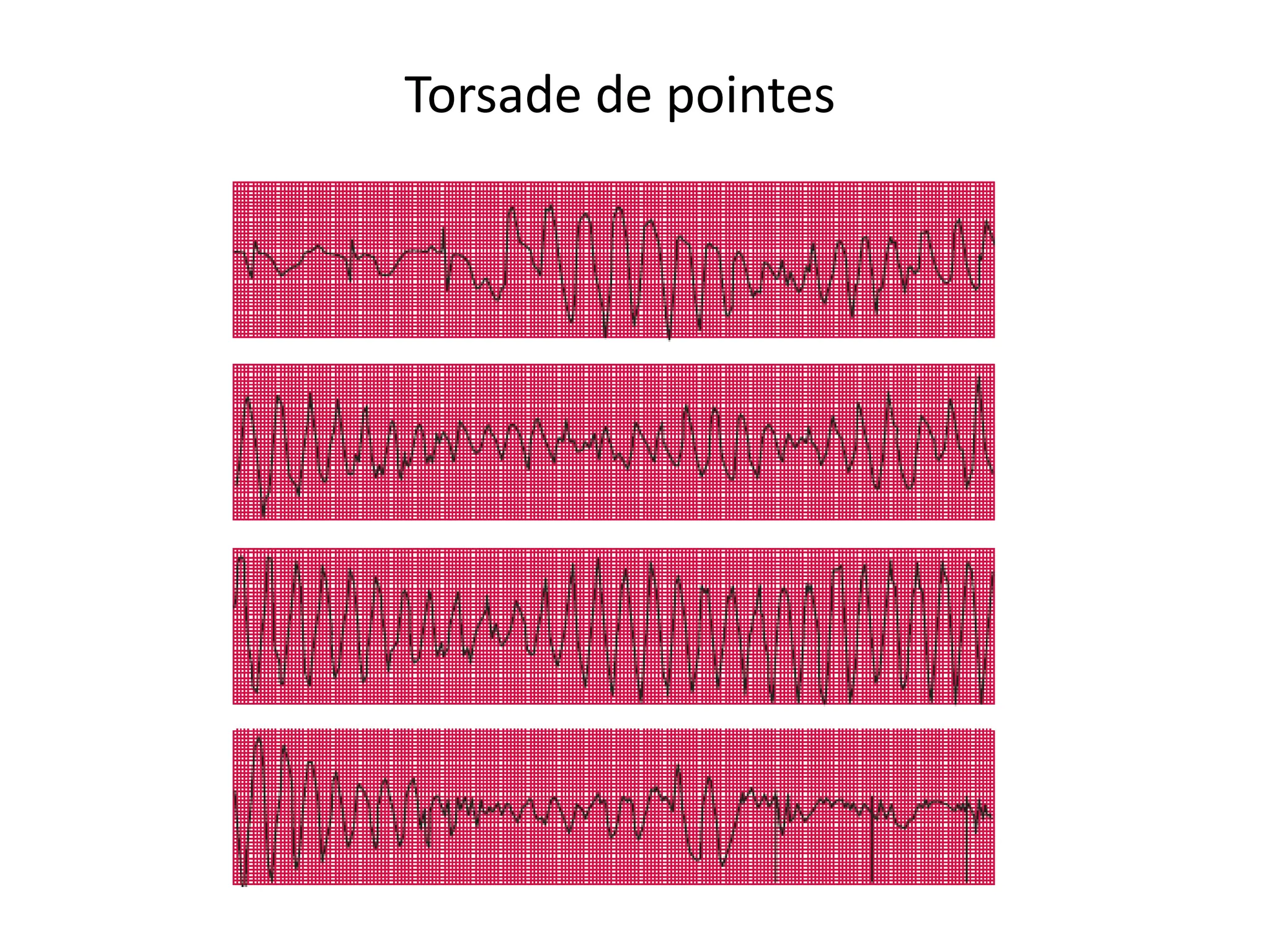 BLS and ACLS Basics of life support.pptx