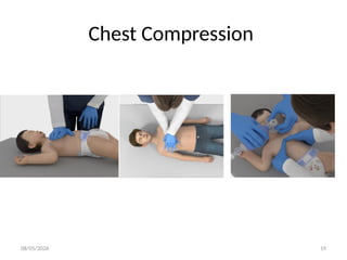 08/05/2026 19
Chest Compression
 