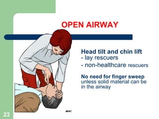 OPEN AIRWAY
Head tilt and chin lift
- lay rescuers
- non-healthcare rescuers
No need for finger sweep
unless solid material can be
seen in the airway
23
 