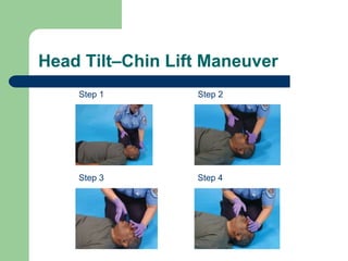 Head Tilt–Chin Lift Maneuver
Step 1 Step 2
Step 3 Step 4
 