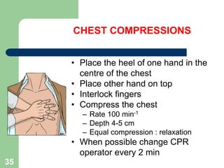 • Place the heel of one hand in the
centre of the chest
• Place other hand on top
• Interlock fingers
• Compress the chest
– Rate 100 min-1
– Depth 4-5 cm
– Equal compression : relaxation
• When possible change CPR
operator every 2 min
CHEST COMPRESSIONS
35
 