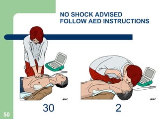 NO SHOCK ADVISED
FOLLOW AED INSTRUCTIONS
30 250
 