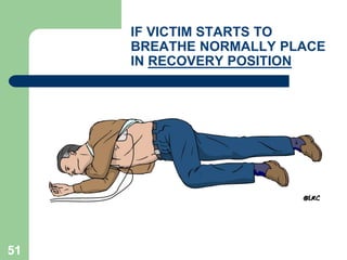 IF VICTIM STARTS TO
BREATHE NORMALLY PLACE
IN RECOVERY POSITION
51
 