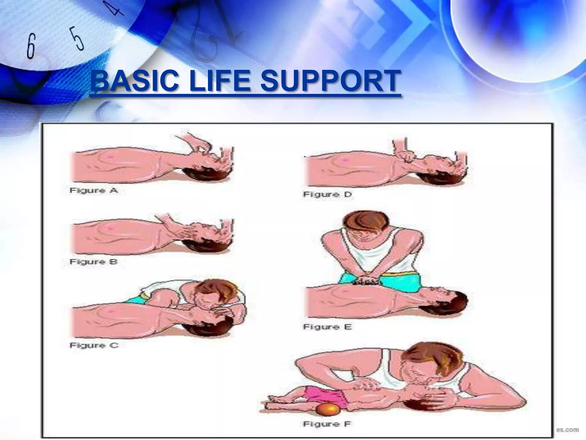 BASIC LIFE SUPPORT